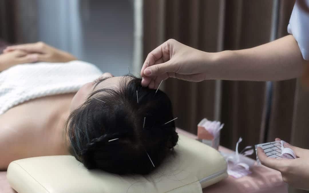 Die Wirksamkeit von Akupunktur und Kräuterheilkunde: Gesünder leben mit Traditioneller Chinesischer Medizin (TCM)